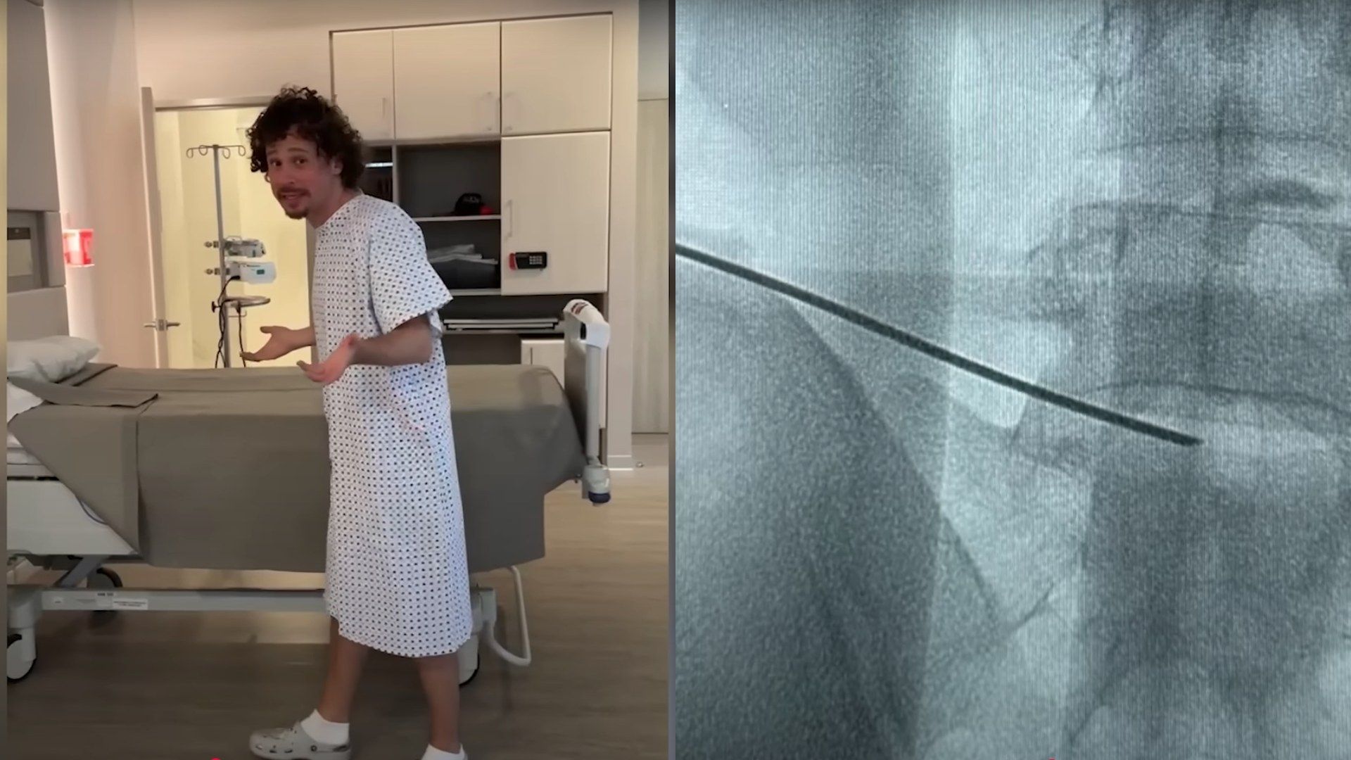 Operan a "Luisito" Comunica de hernias discales.