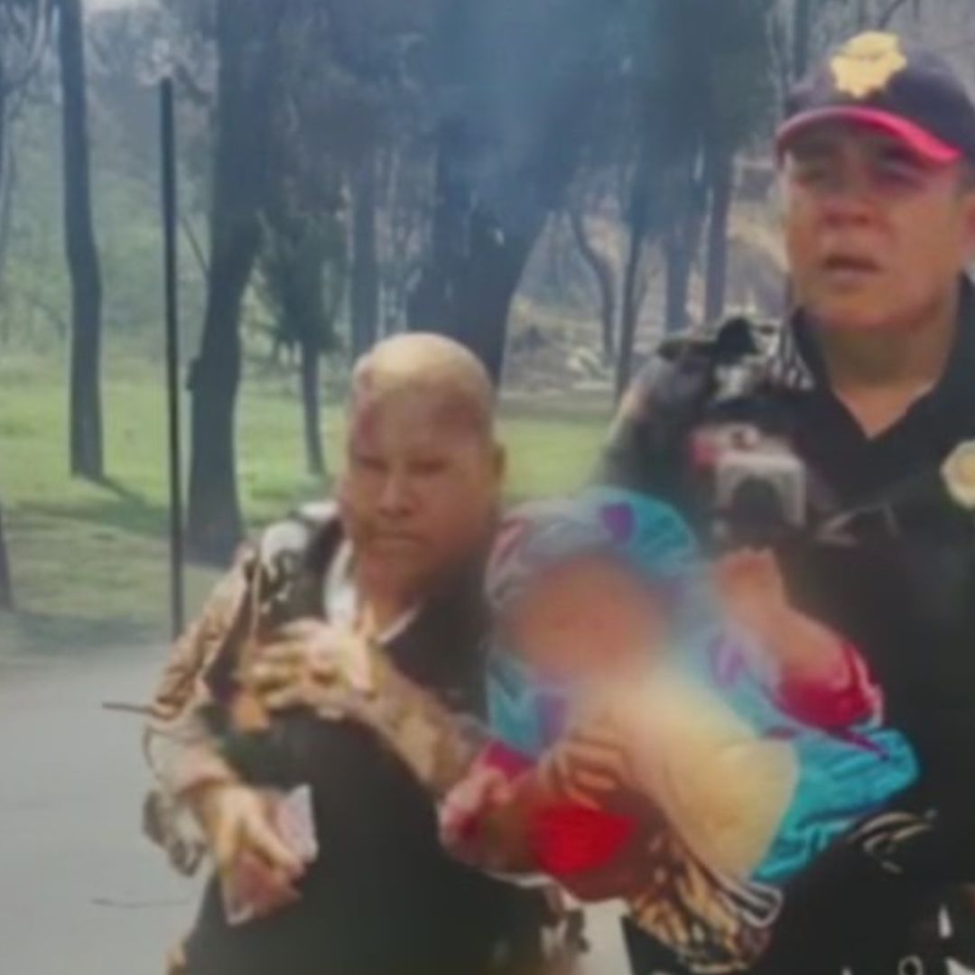 ¿Qué Sabemos de la Salud de la Abuelita Que Salvó a Su Nieta Tras Explosión en Iztapalapa?