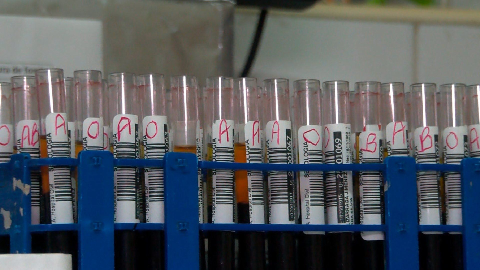 Acusan a un presunto doctor por brote de hepatitis C en Tepatitlán