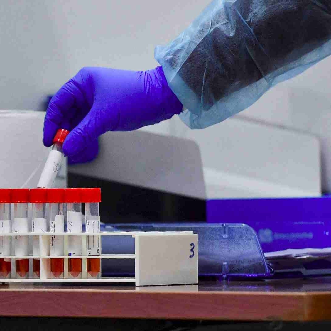 Advierten por variante BA.3.2 de la covid, ¿llegará a México?