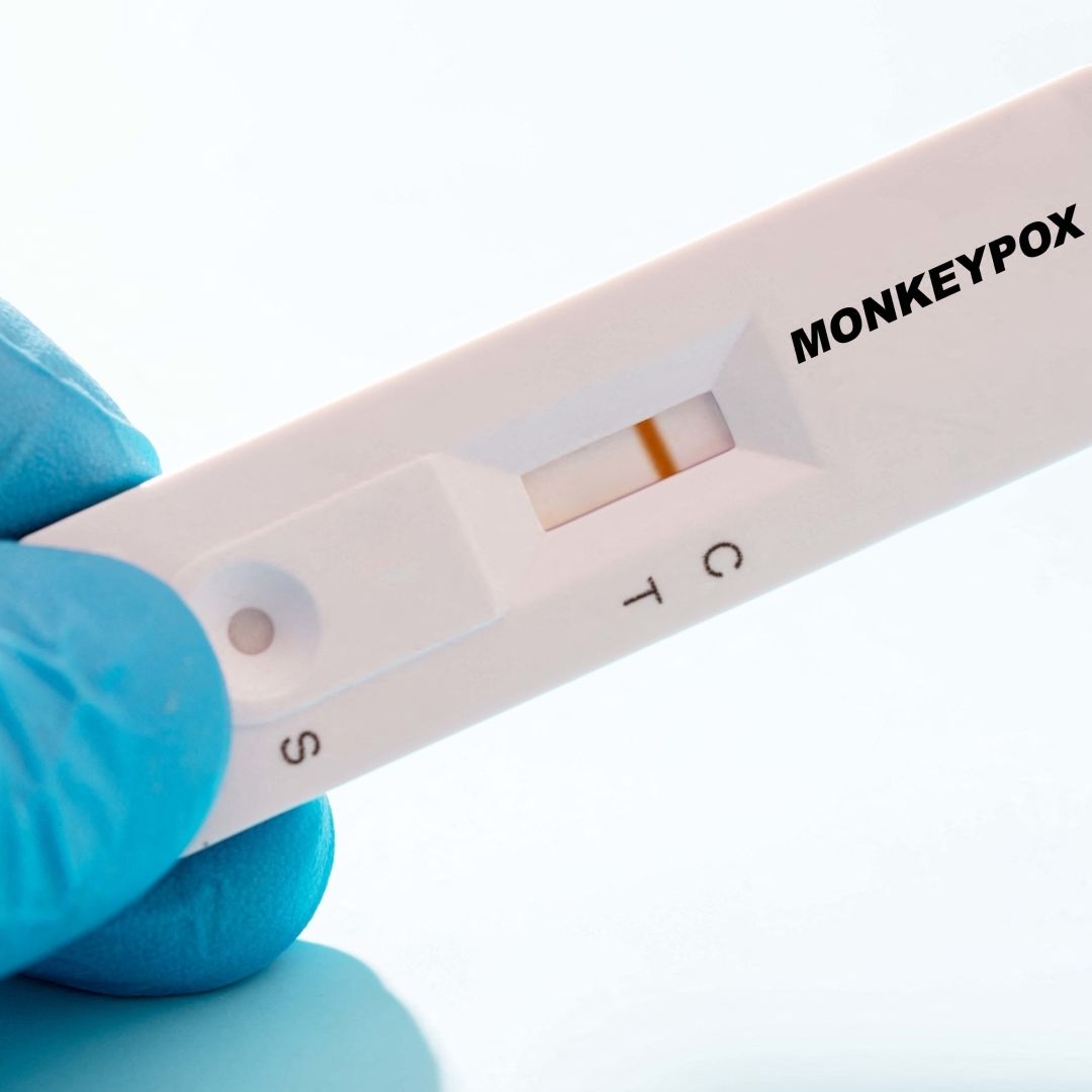 El Primer Caso de Mpox Fuera de África es en Suecia