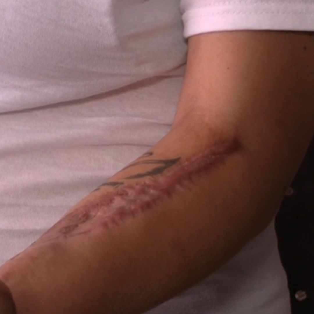 La bala ingresó por la cara, el tórax y salió por el brazo
